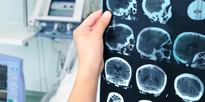 Best neurologist doctor in Dubai