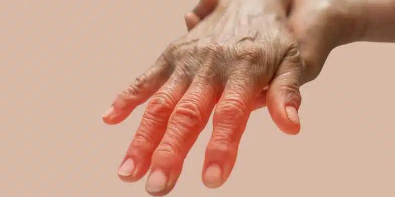 ension headache treatment Dubai